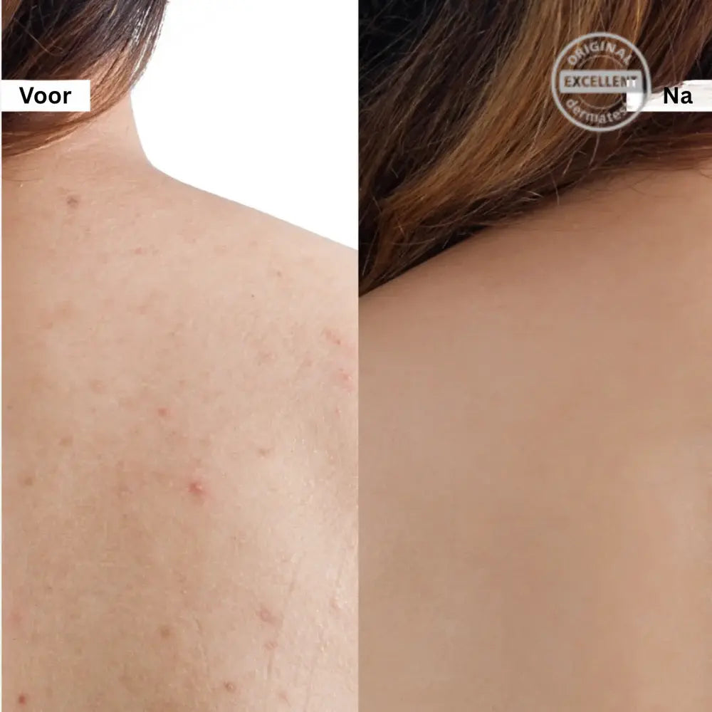 Crema Facial Reafirmante Poros Sal Rosa 50g – imagen 2