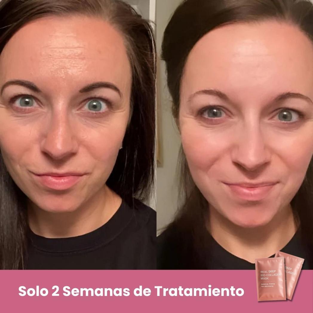 Pack 5 Mascarillas Faciales de Biocolágeno – imagen 4